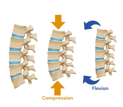 Compression-flexion
